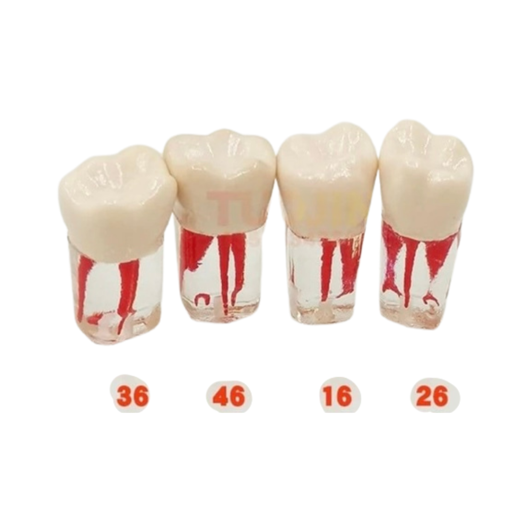 Omega Endodontik Kronlu Kanallı Dişler